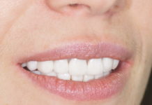 Методы отбеливания зубов