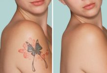 Как свести татуировку